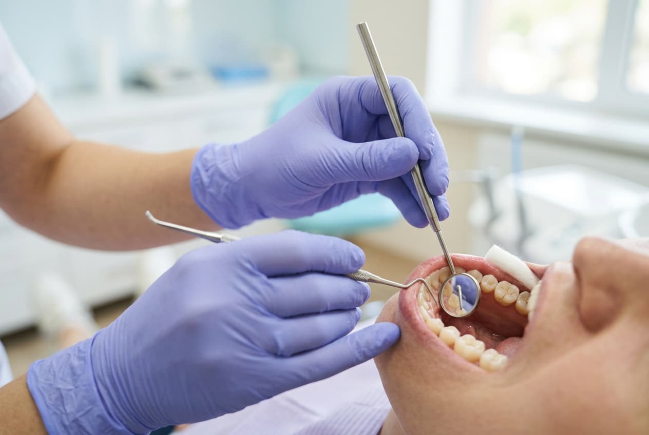 Gros plan de mains gantées utilisant un miroir dentaire pour examiner une dent