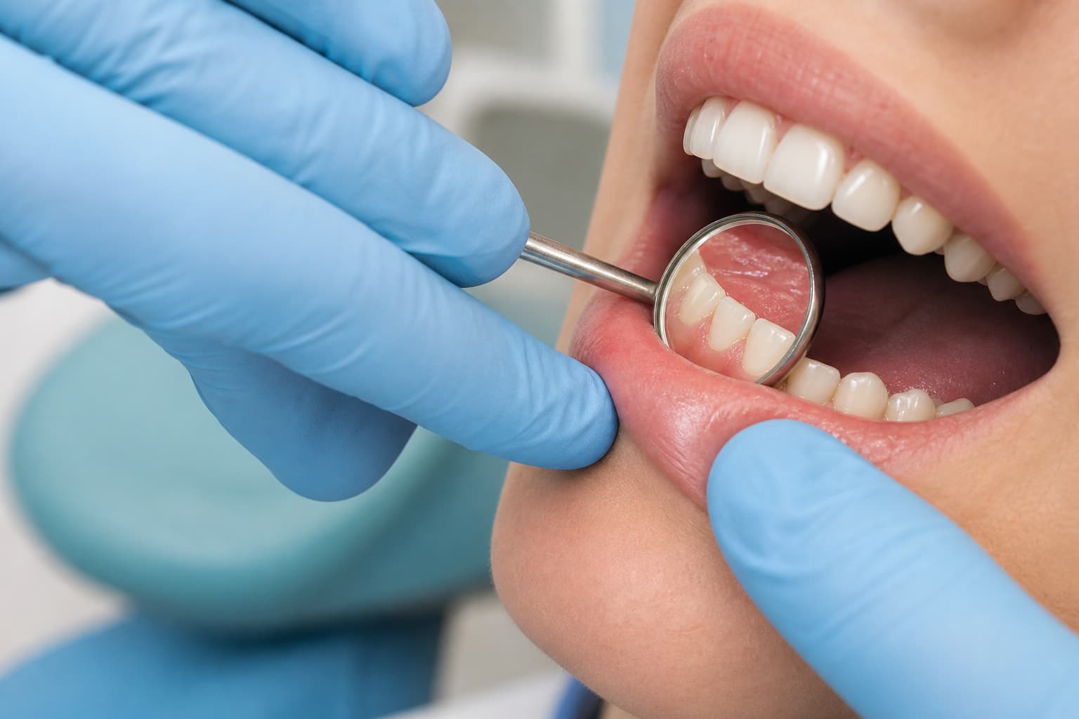 Examen dentaire générique d’une gencive avec un miroir buccal